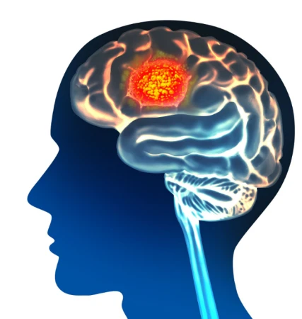  Pramiracetam powder