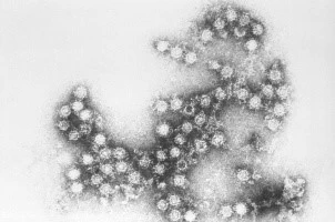 Coxsackie virus Coxsackie virus